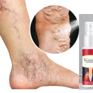 Varcose Venis Spray (Pack of 2)